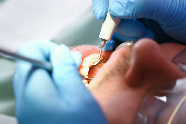 Best Weekend Emergency Dentist in Landis, NC