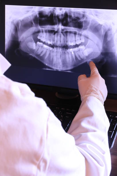 Best Urgent Care for Lost Fillings or Crowns in Landis, NC