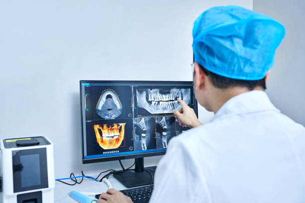 Best Emergency Wisdom Teeth Removal in Landis, NC